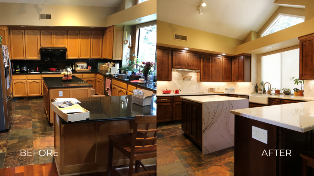 Refacing Before & After